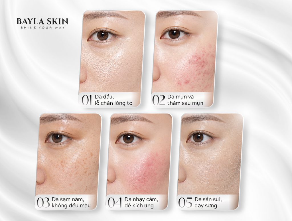 Niacinamide-Baylaskin 2