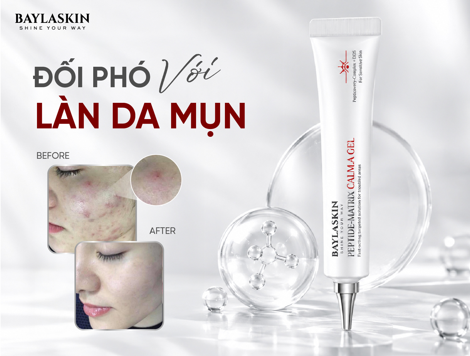 Chiến Thuật Đối Phó Với Mụn: Từ Nguyên Nhân Hình Thành, Thâm Đỏ PIE Đến Lý Do Nên Chọn Serum Trị Mụn Phục Hồi Peptide